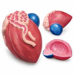 Male Bladder and Prostate Anatomy Model - Median Section