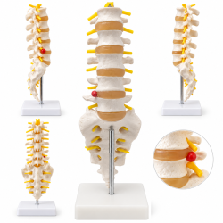 Human Lumbar Spine Model - Life-Size with Sacrum and Herniated Disc